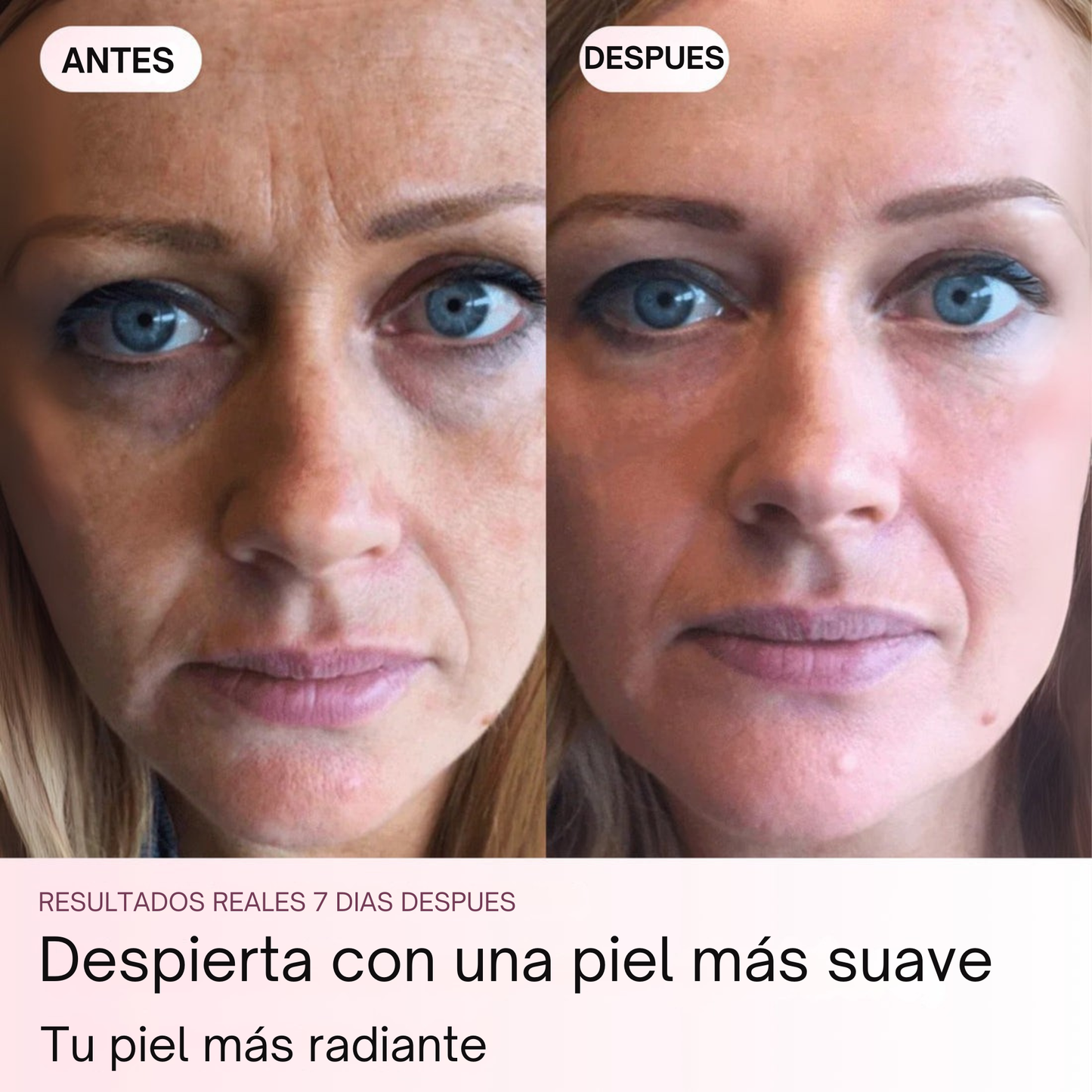 Elimina las arrugas en 7 días con Glowra