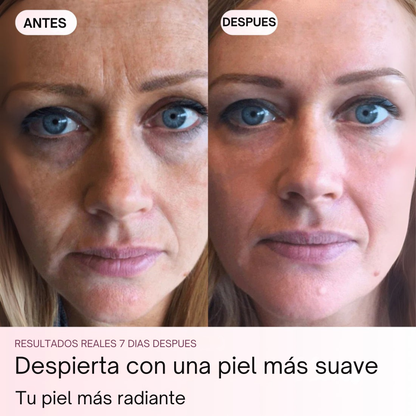 Elimina las arrugas en 7 días con Glowra